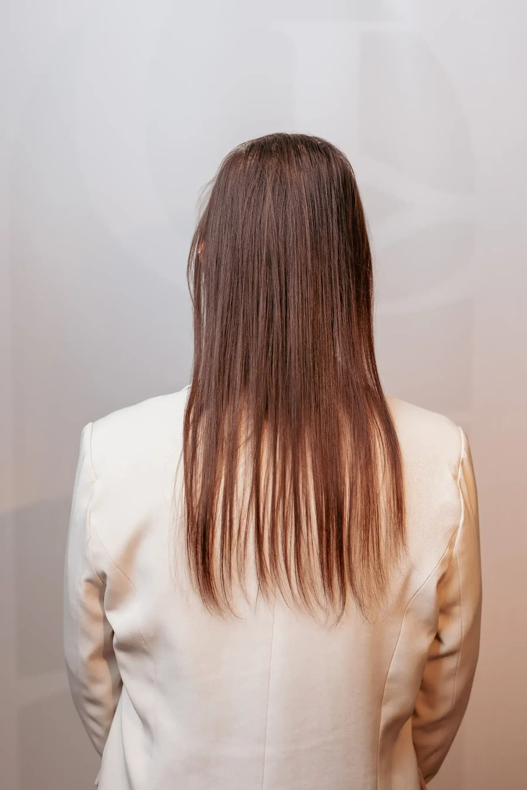 Voor: klant met halflang bruin haar, vóór de medische haaroplossing
